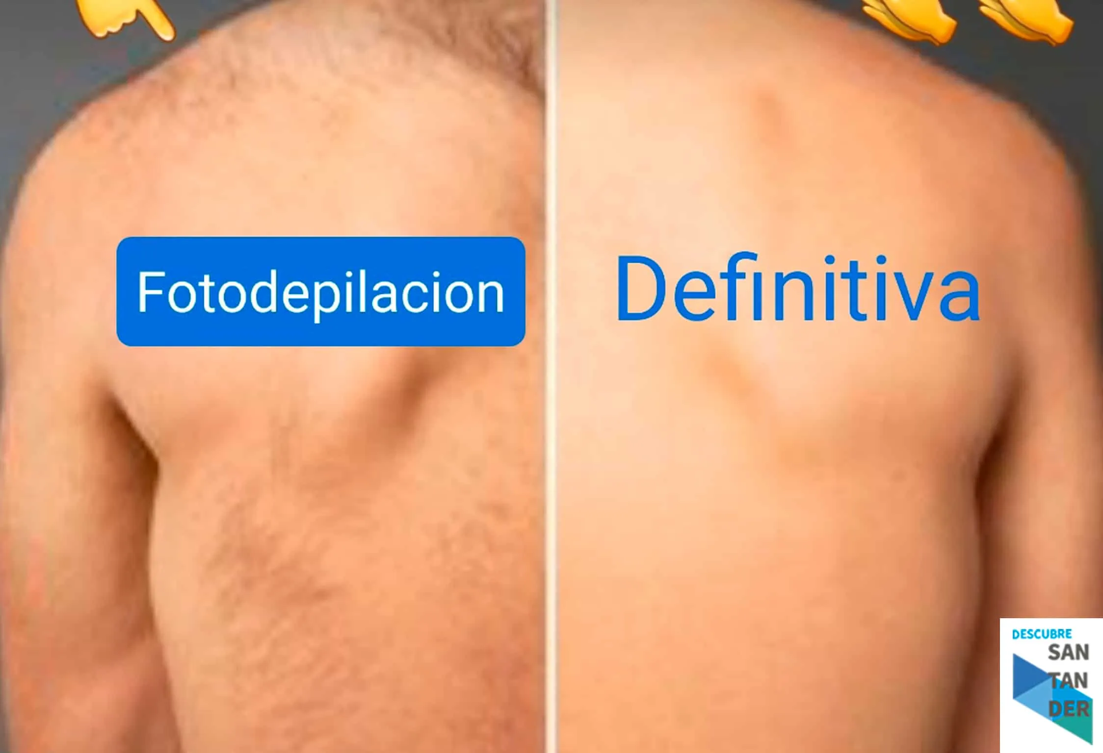 Depilación for Men - Estética Inma Martínez